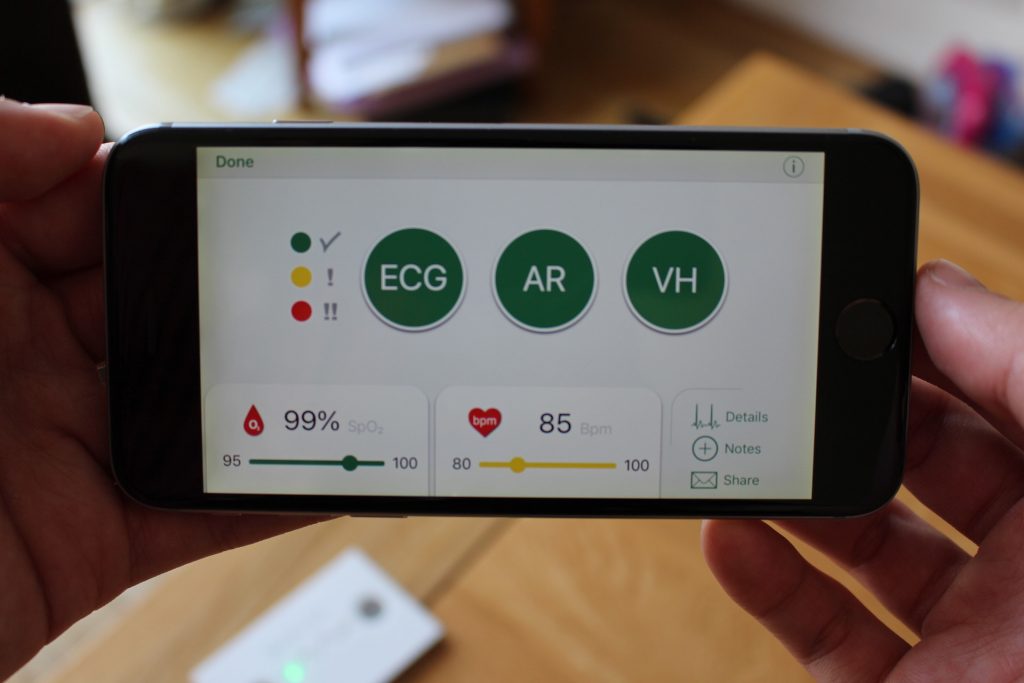 Wiwe, the Mobile ECG: Track Your Heart Rate and Blood Oxygen Level on the  Go